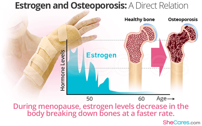 Importance of hormone health for maintaining bone density